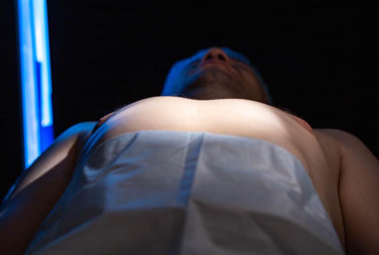 La chirurgie de la gynécomastie