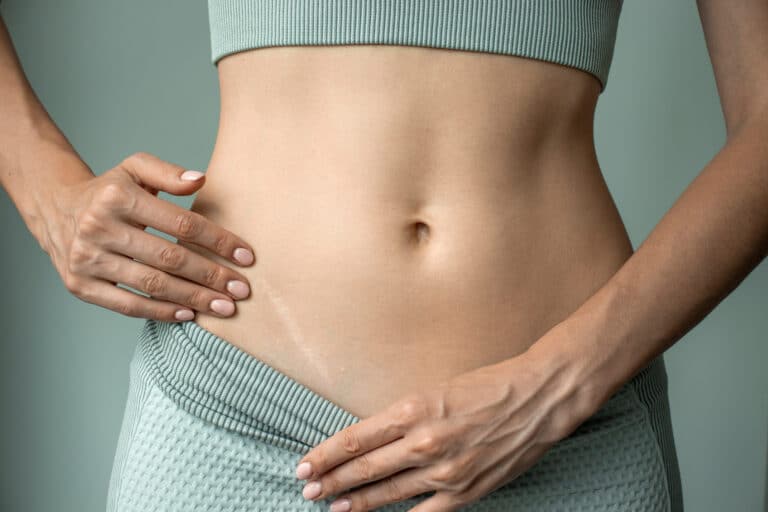Chirurgie esthétique et cicatrices : minimiser les risques