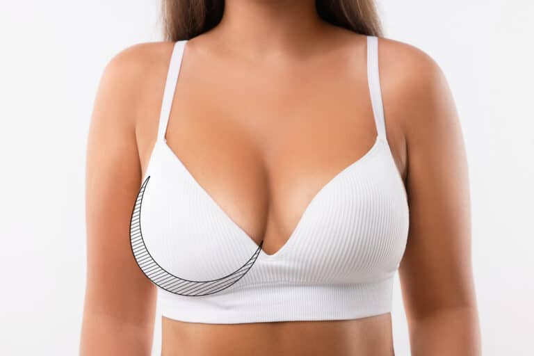 Woman with breast asymmetry on white background, closeup