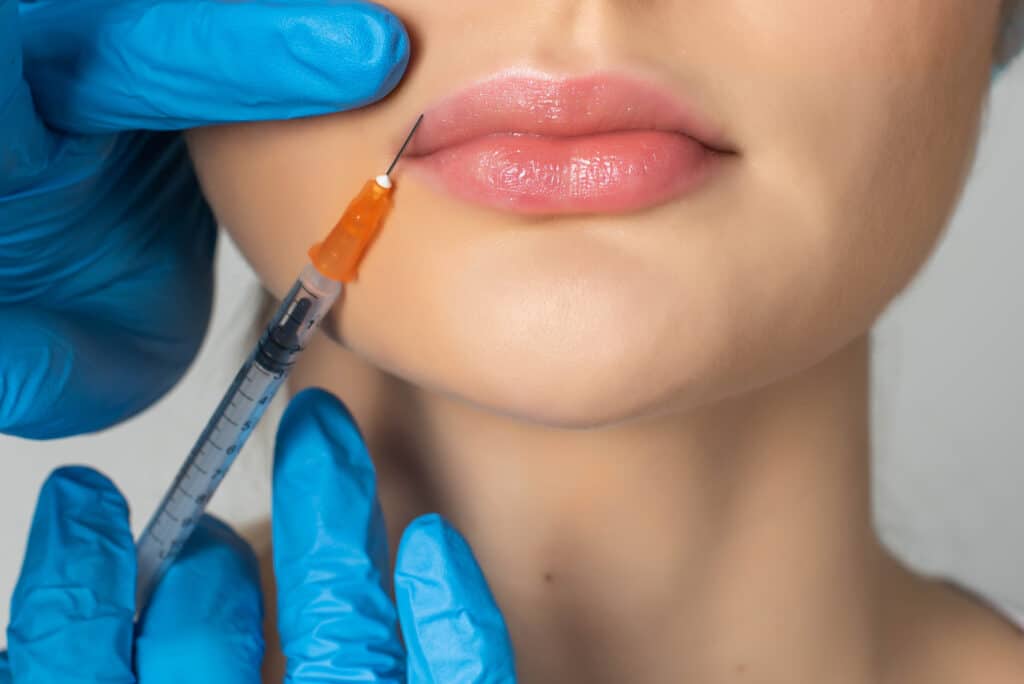 profiloplastie